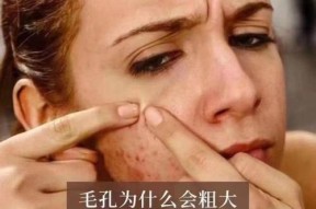 毛孔粗大怎么办？找出导致毛孔粗大的原因并解决