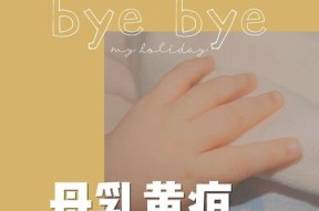 新生儿母乳性黄疸怎么判断？有哪些症状和处理方法？