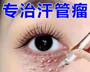 去除眼部脂肪粒的小妙招（告别眼部脂肪粒）  第2张