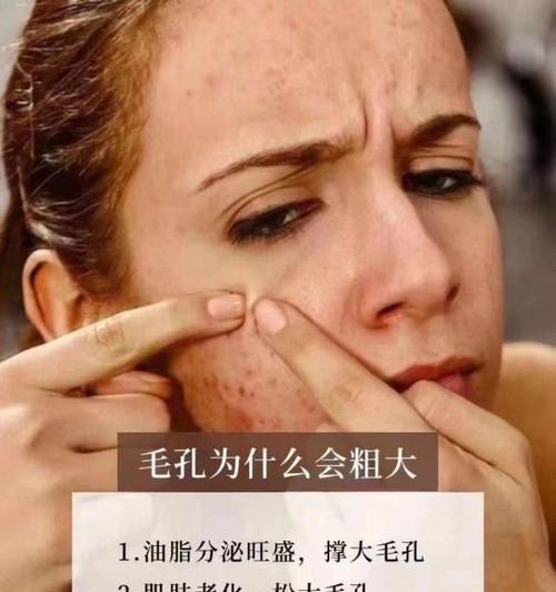 毛孔粗大怎么办？找出导致毛孔粗大的原因并解决  第1张