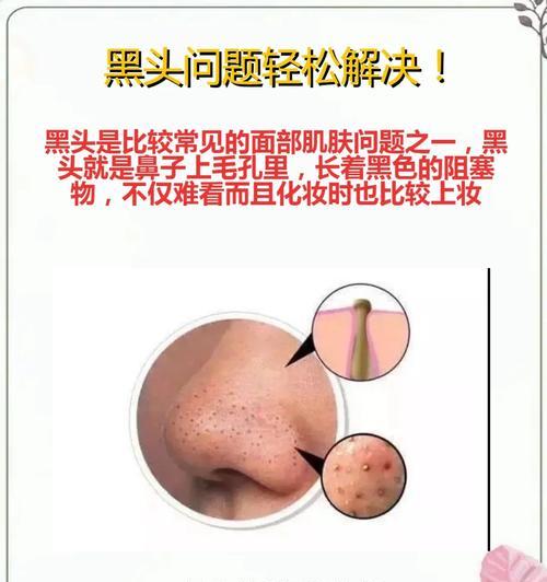 毛孔粗大怎么办？找出导致毛孔粗大的原因并解决  第3张