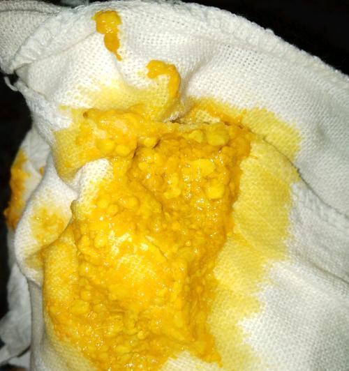宝宝吃母乳拉稀正常吗？如何判断和处理？  第3张