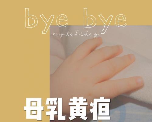 新生儿母乳性黄疸怎么判断？有哪些症状和处理方法？  第1张