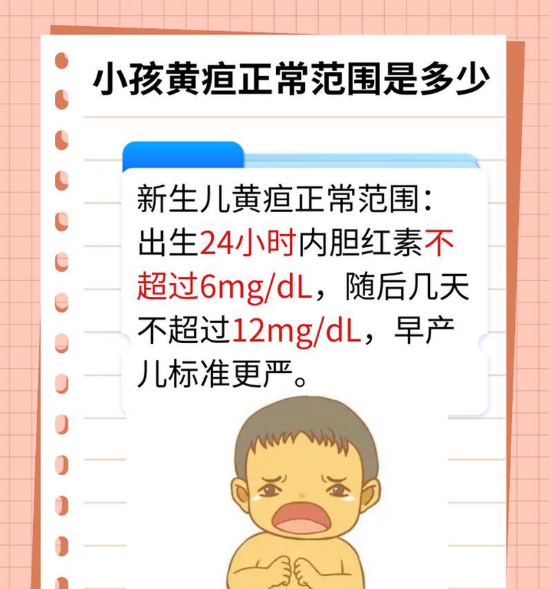 新生儿母乳性黄疸怎么判断？有哪些症状和处理方法？  第2张